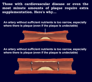 widen arteries