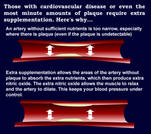 widen arteries