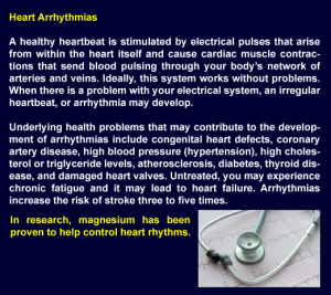 heart arrhythmias