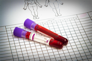 vitamin D blood levels
