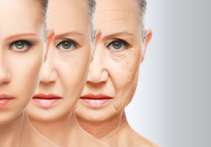 aging